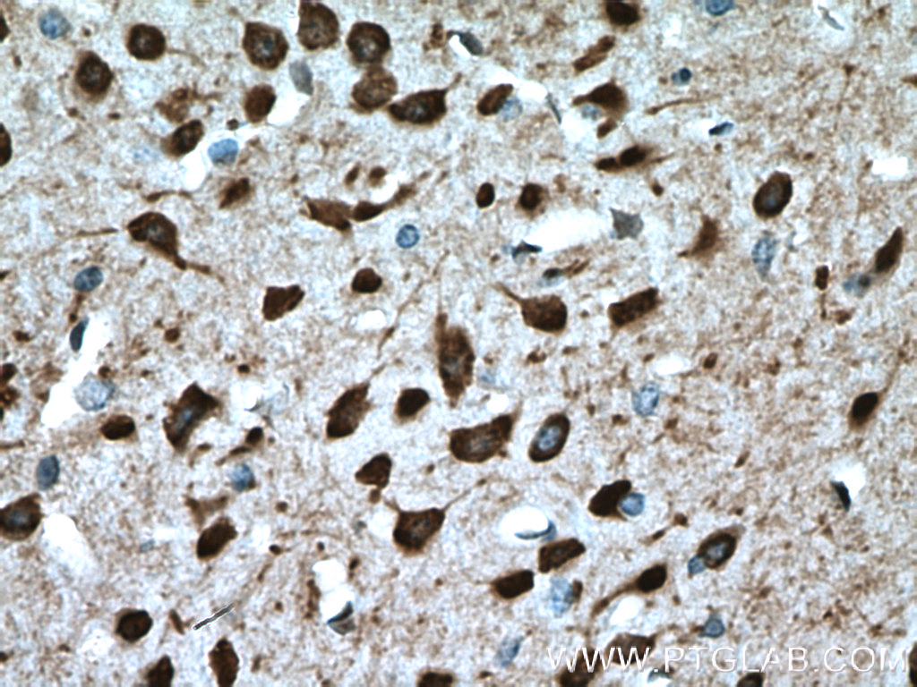 PCP4L1 Polyclonal antibody