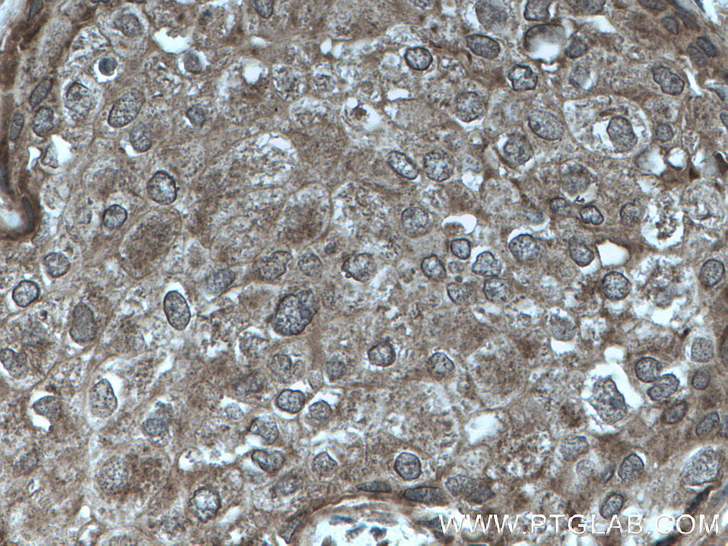 PTPN13 Polyclonal antibody