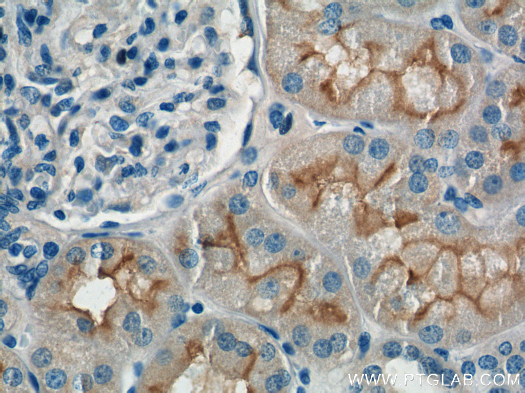 XPNPEP2 Polyclonal antibody