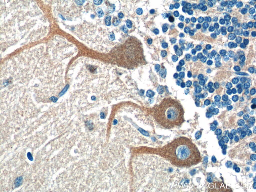 CSF1R Polyclonal antibody
