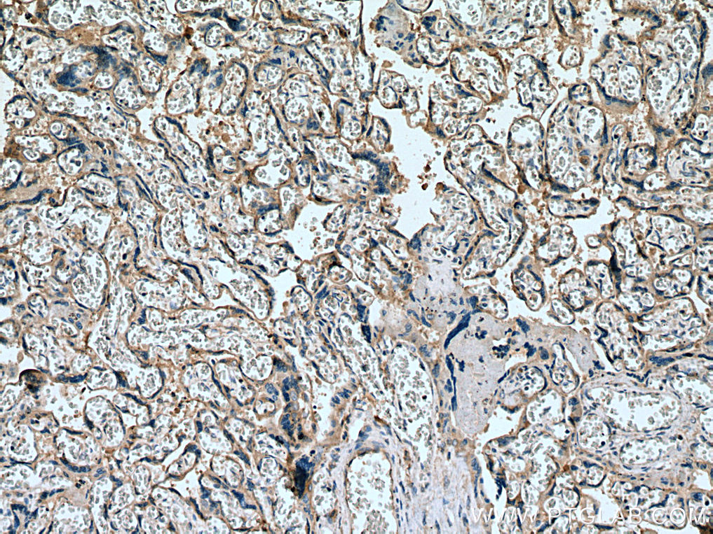 SLC19A1 Polyclonal antibody