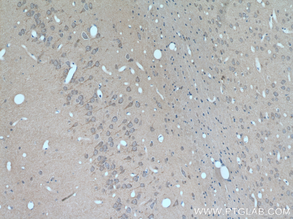 GALNT9 Polyclonal antibody