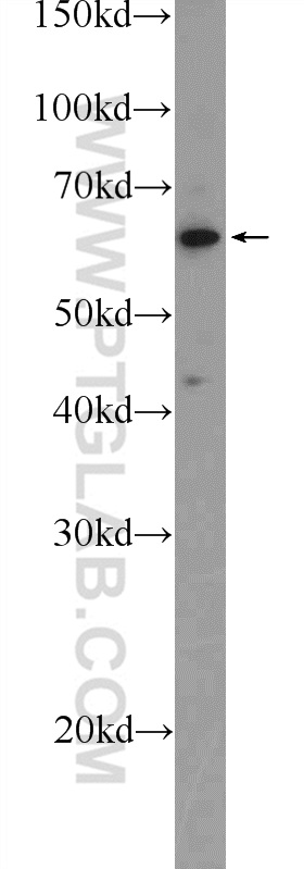 TESPA1 Polyclonal antibody