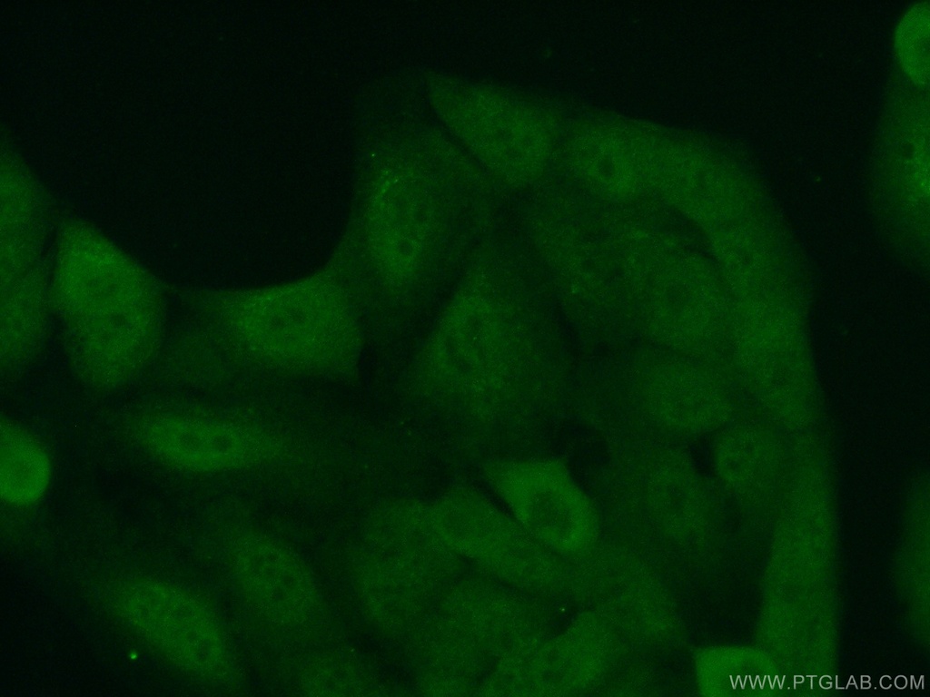 FMN1 Polyclonal antibody