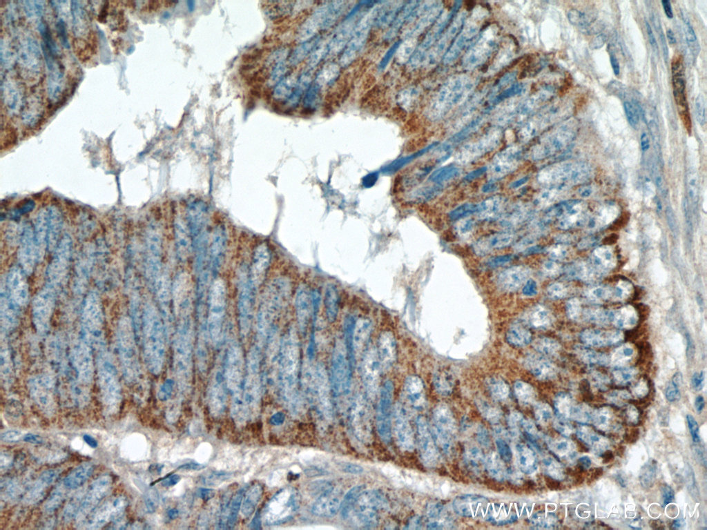 TMEM184A Polyclonal antibody