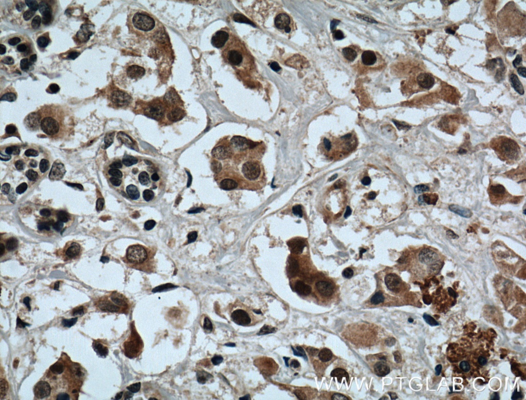XBP-1U specific Polyclonal antibody