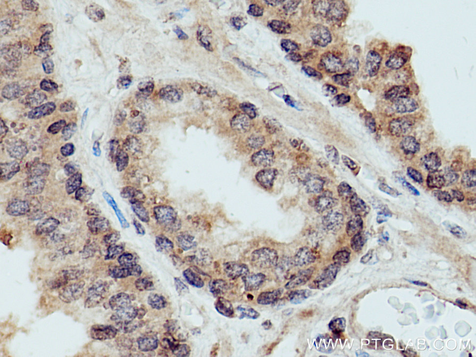 KIF14 Polyclonal antibody