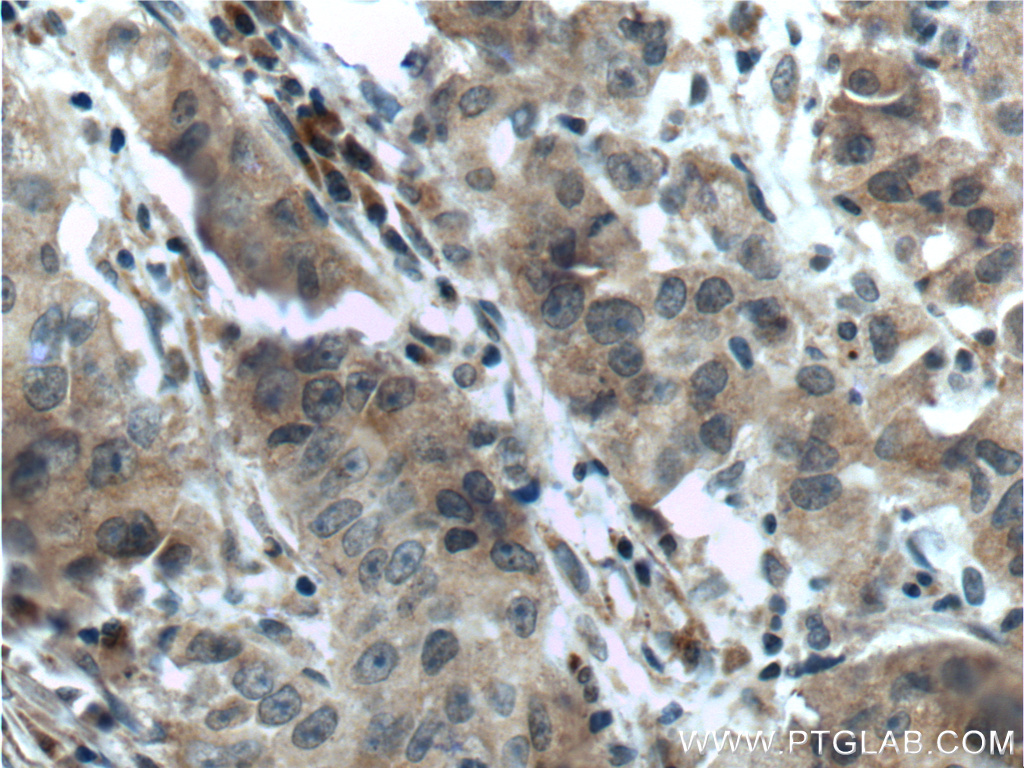 SRD5A1 Polyclonal antibody
