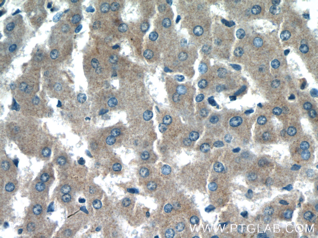 NDUFAF4 Polyclonal antibody