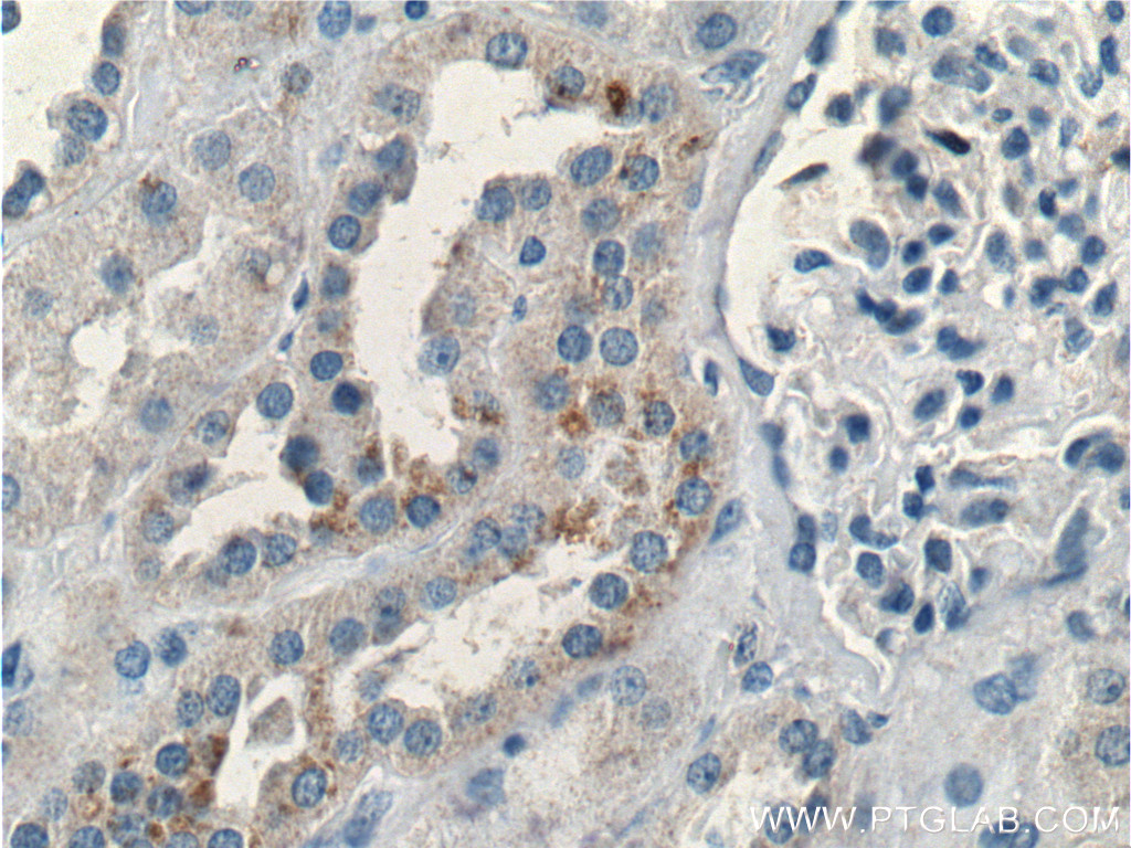 BRAP Polyclonal antibody