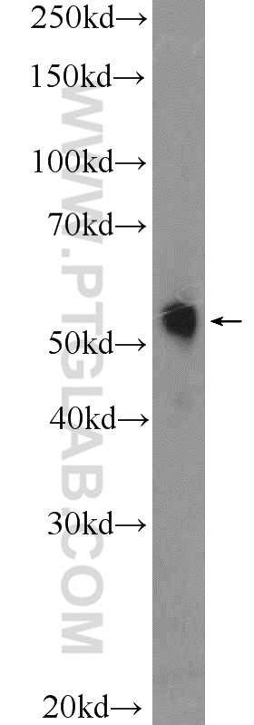 TRMT61B Polyclonal antibody