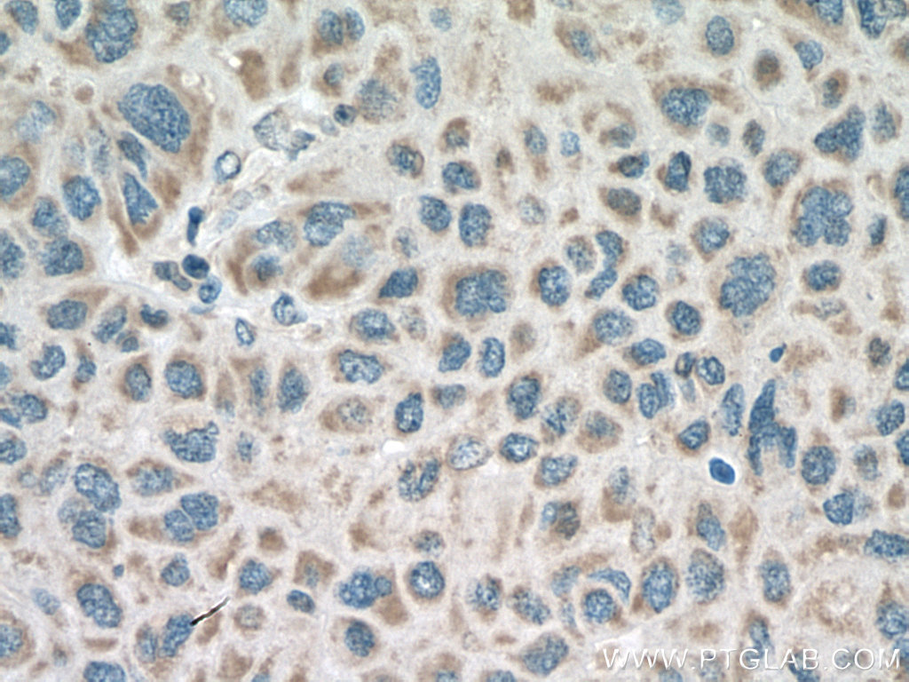 RNF128 Polyclonal antibody
