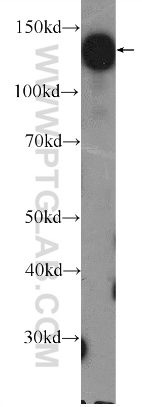 HISPPD1 Polyclonal antibody
