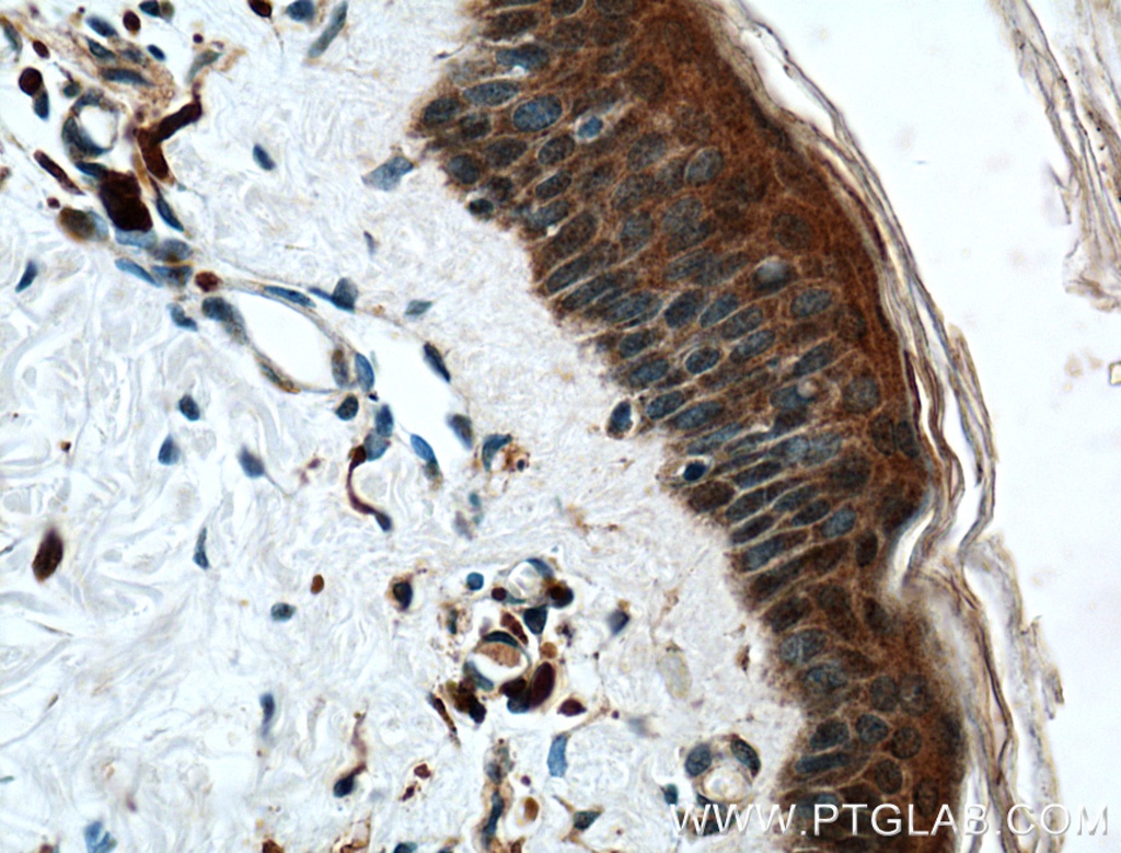 CHRNA9 Polyclonal antibody