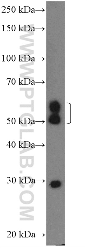 CHST2 Polyclonal antibody