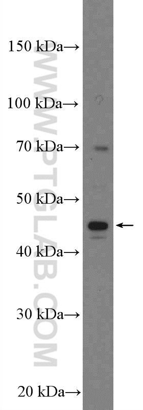 PEDF Polyclonal antibody