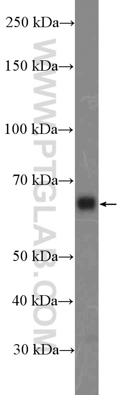 ITPRIP Polyclonal antibody