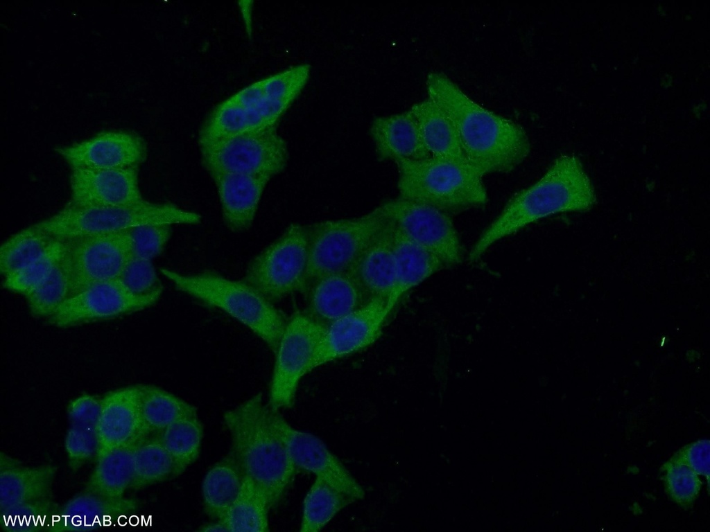 Ezrin Polyclonal antibody