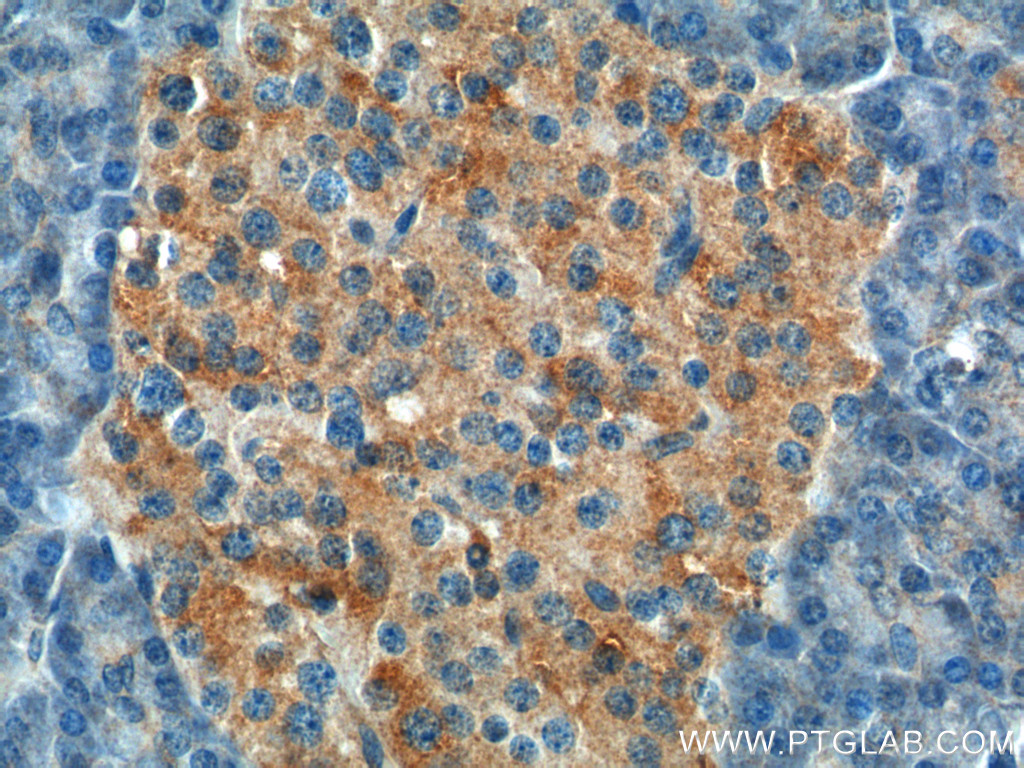 UBR1 Polyclonal antibody