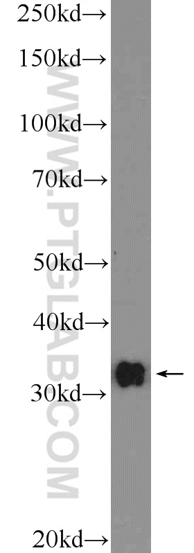 CLEC12B Polyclonal antibody