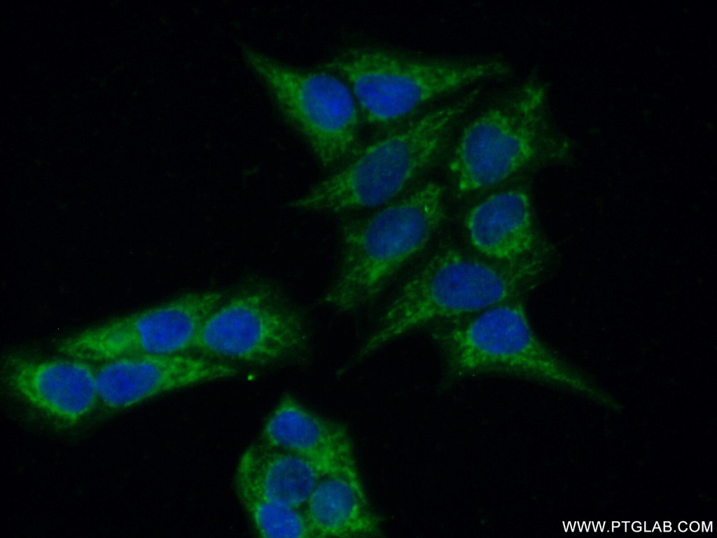 MAP9 Polyclonal antibody