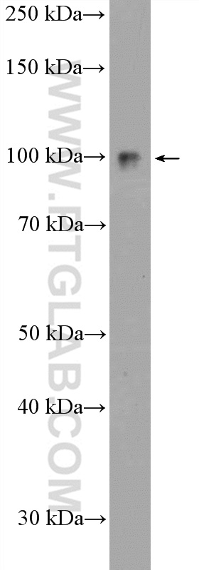 UFL1 Polyclonal antibody
