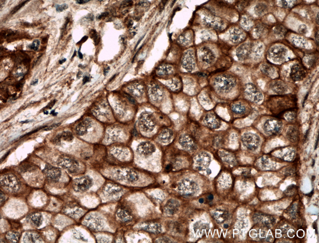 ECE1 Polyclonal antibody