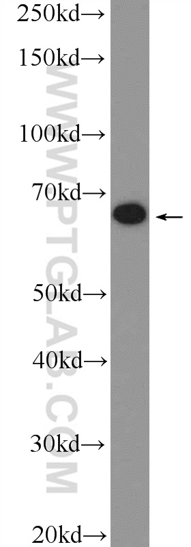 MBTD1 Polyclonal antibody