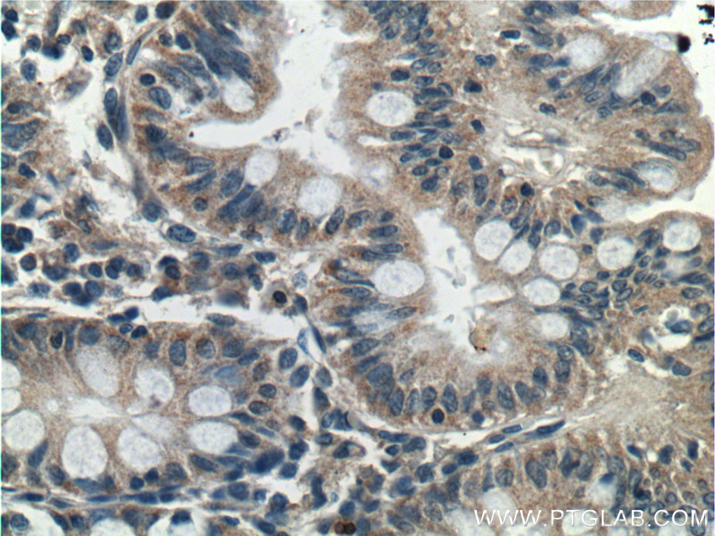 C12orf69 Polyclonal antibody