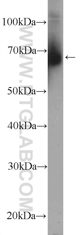 ZFP90 Polyclonal antibody