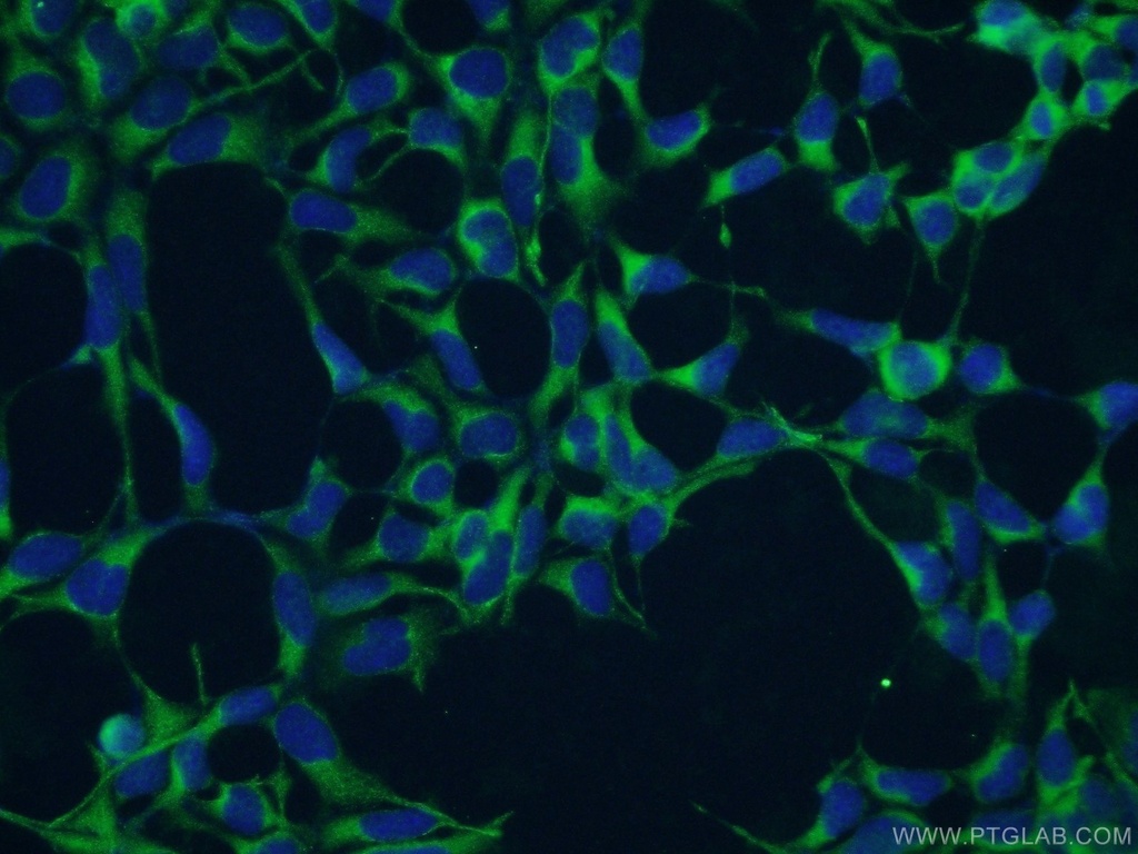 GHDC Polyclonal antibody