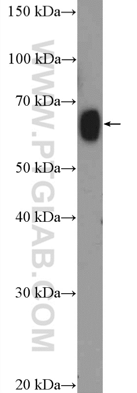 ZNF470 Polyclonal antibody