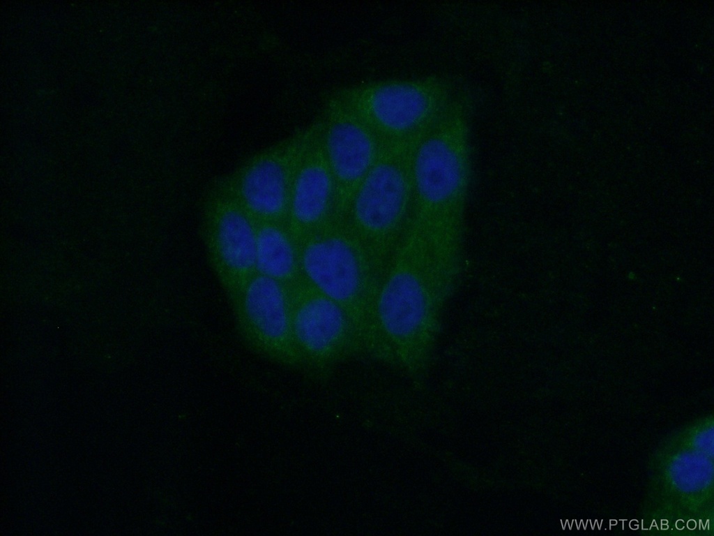 HDHD2 Polyclonal antibody