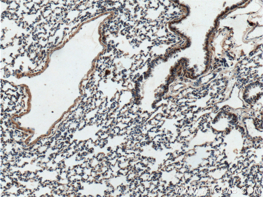 Vegfa Polyclonal antibody