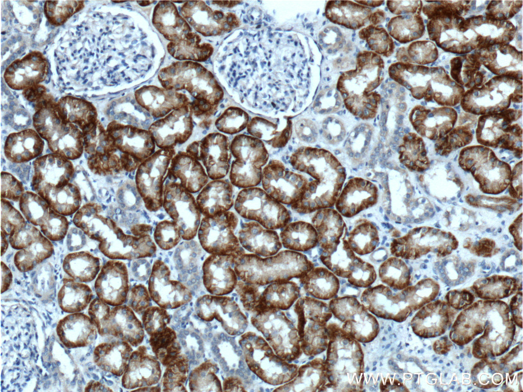 SLC13A3 Polyclonal antibody