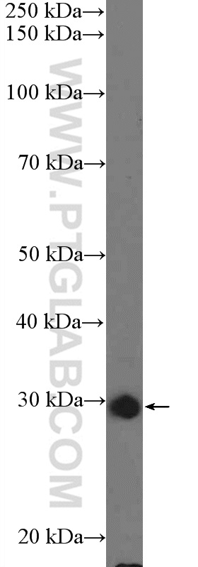 C15orf23 Polyclonal antibody