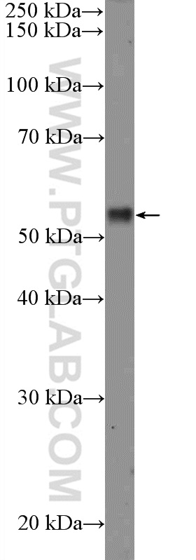 RPS6KB2 Polyclonal antibody