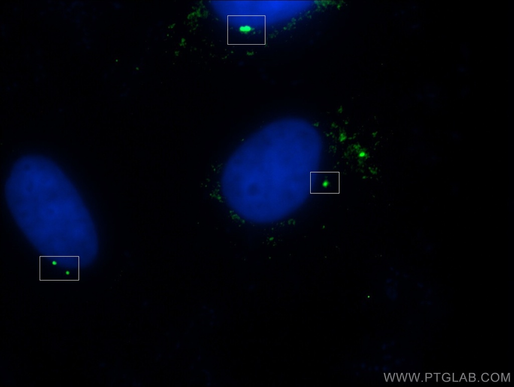 Gamma Tubulin Polyclonal antibody