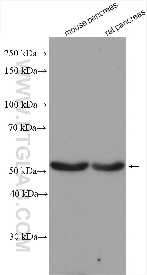 GLP1R Polyclonal antibody
