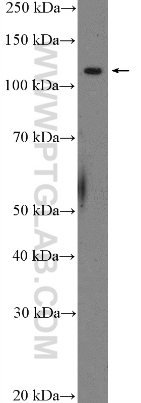 MYT1 Polyclonal antibody