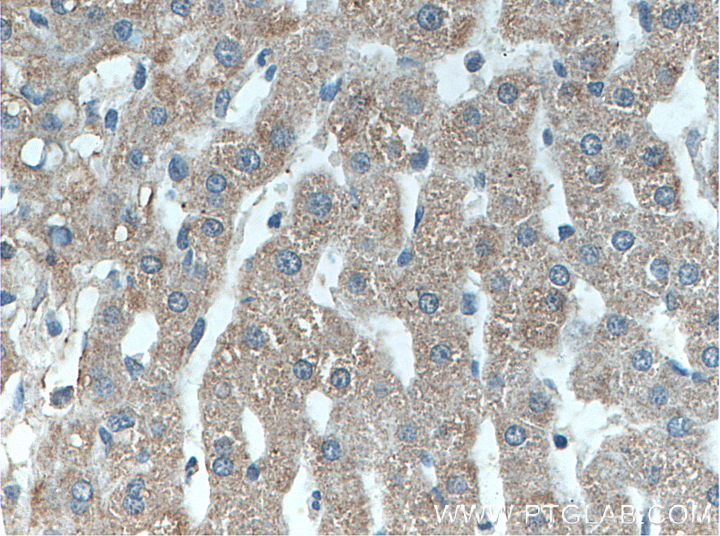 Piezo2 Polyclonal antibody