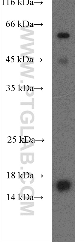 POLD4 Polyclonal antibody