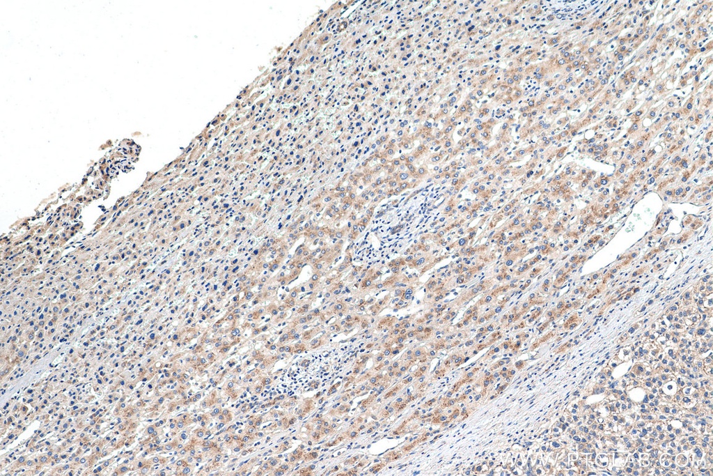 EDEM1 Polyclonal antibody
