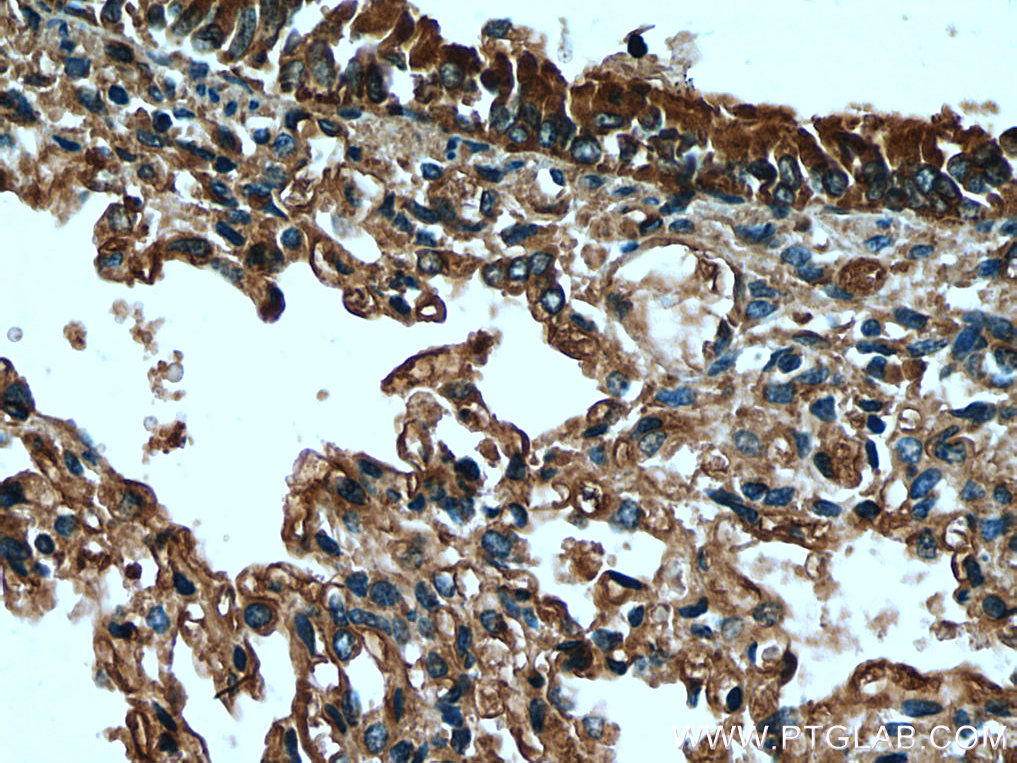 SCGB3A2 Polyclonal antibody