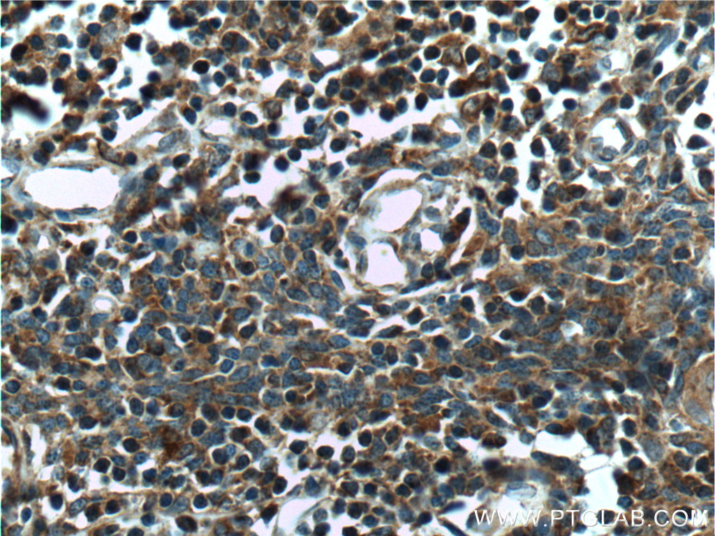 COMMD3 Polyclonal antibody