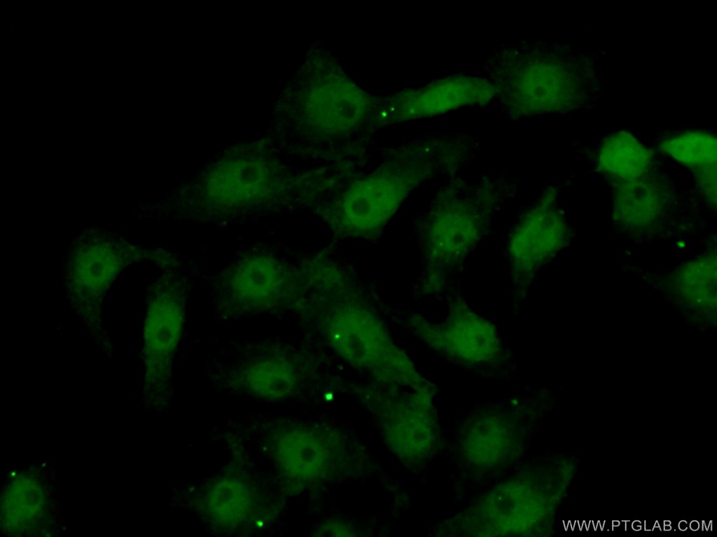 DLX2 Polyclonal antibody