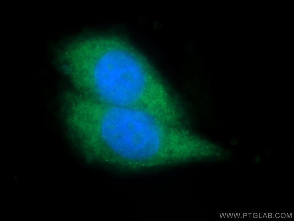 TAOK1 Polyclonal antibody