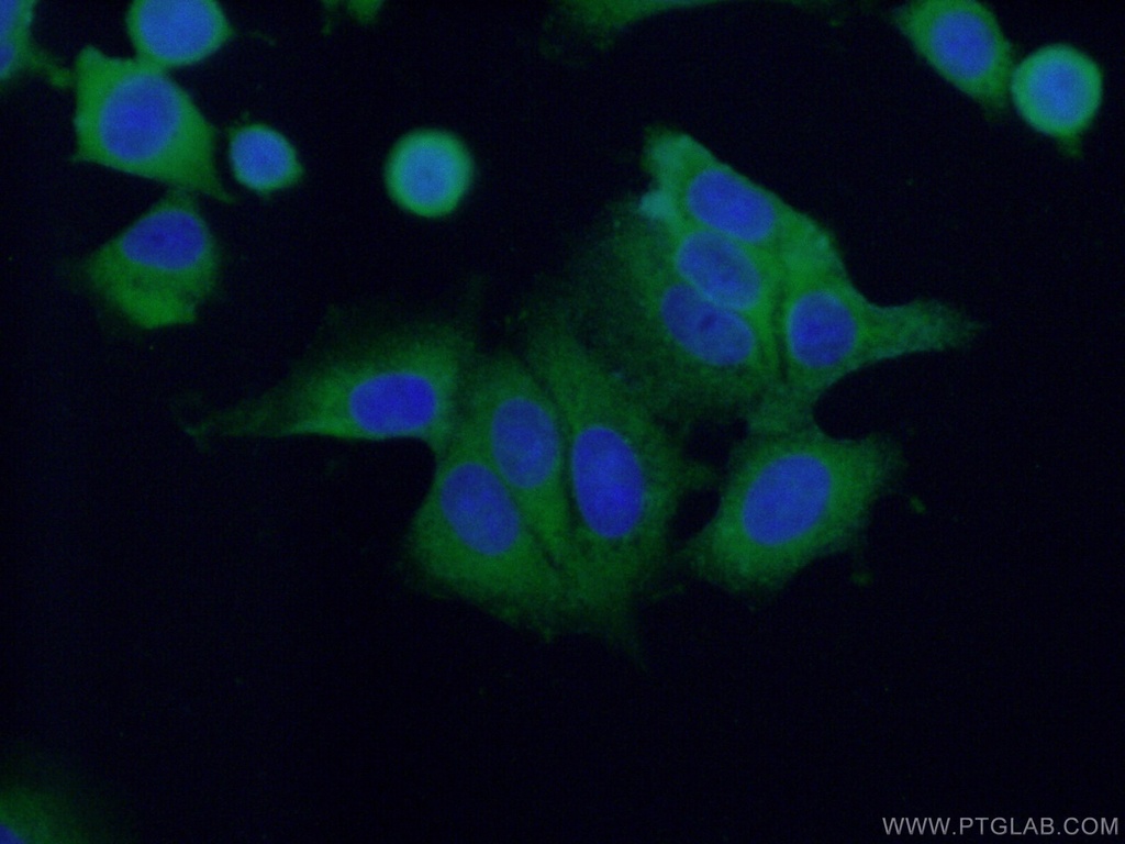 PUM1 Polyclonal antibody
