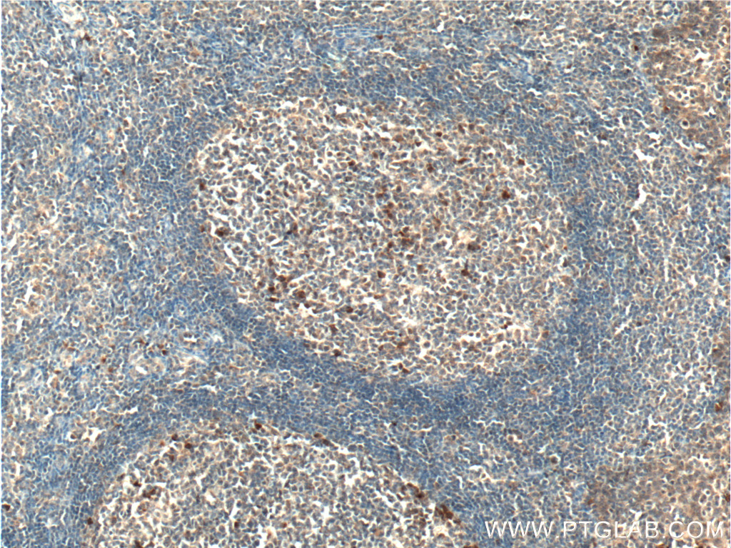 CLEC16A Polyclonal antibody