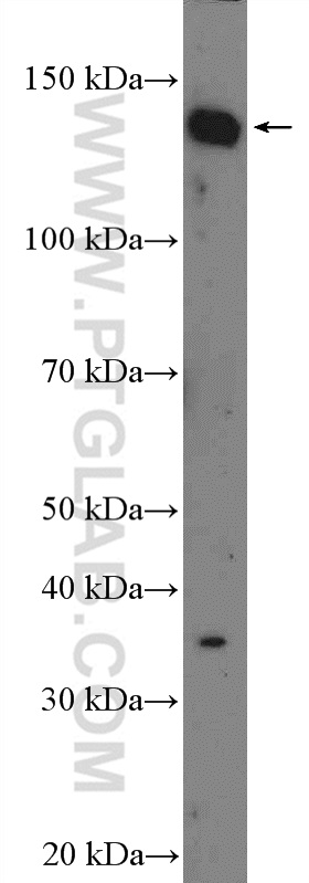 C14orf106 Polyclonal antibody